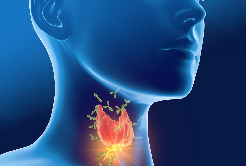 Is HEAVY METAL POISONING Causing My Thyroid Symptoms?