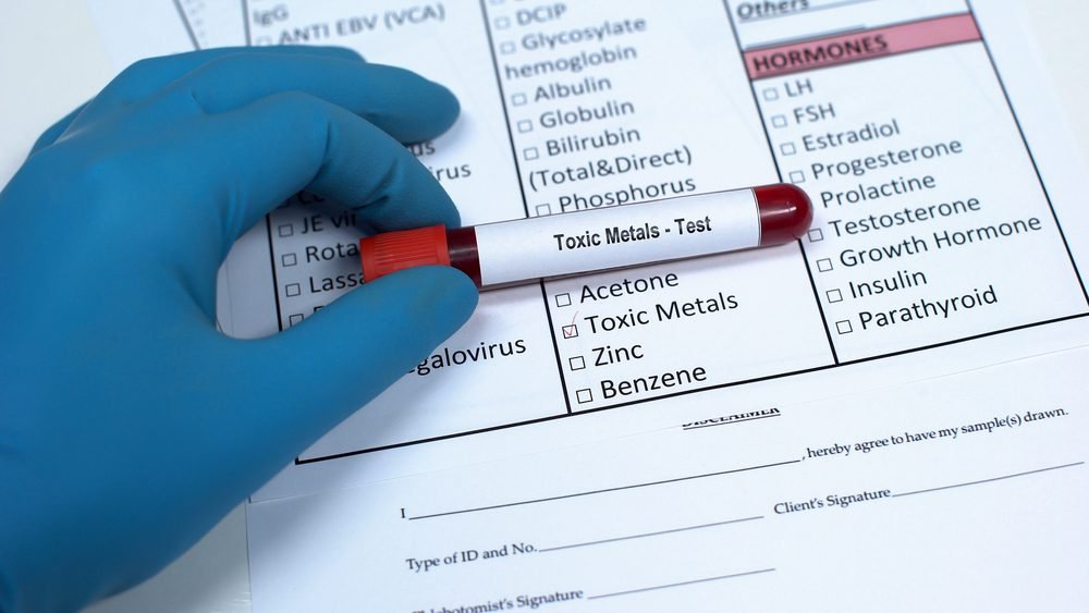 Toxic metals, doctor showing blood sample in tube, lab research, health checkup