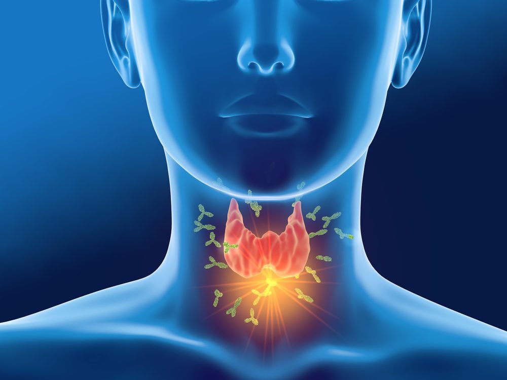 Making Sense of Thyroid Antibodies – Why Are Mine So High