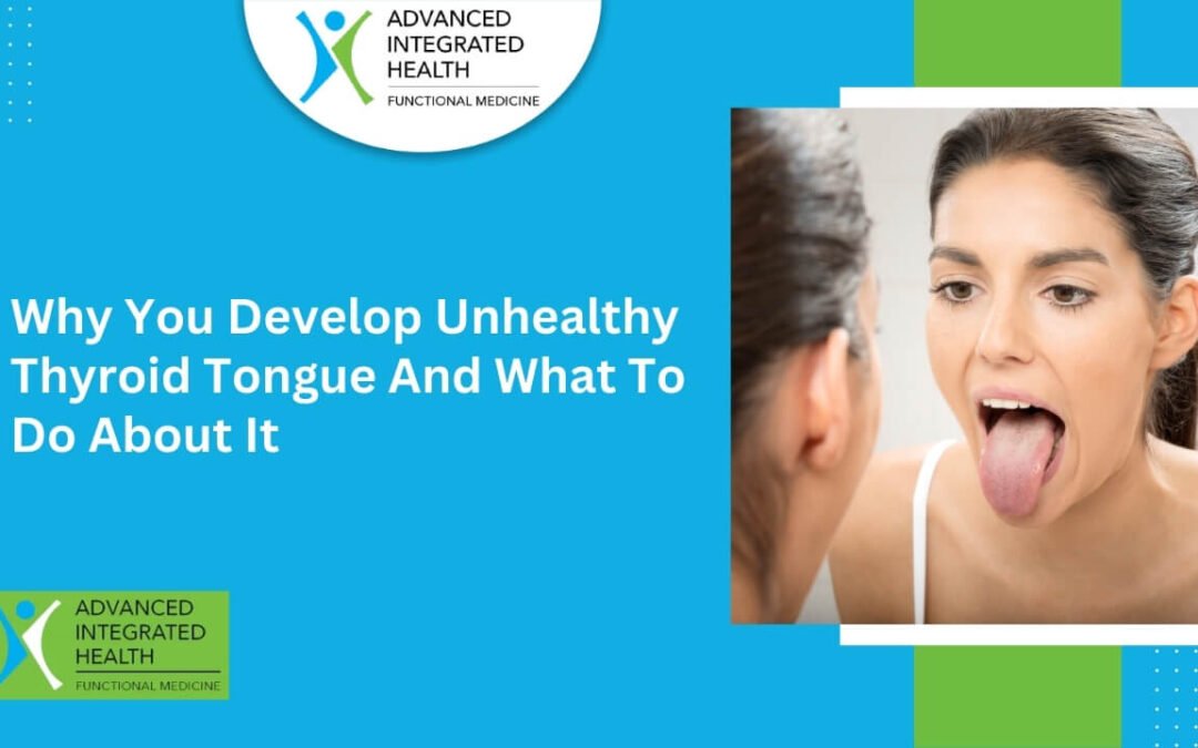 Why You Develop Unhealthy Thyroid Tongue And What To Do About It