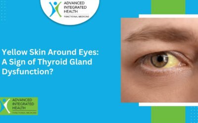 Yellow Skin Around Eyes: A Sign of Thyroid Gland Dysfunction?