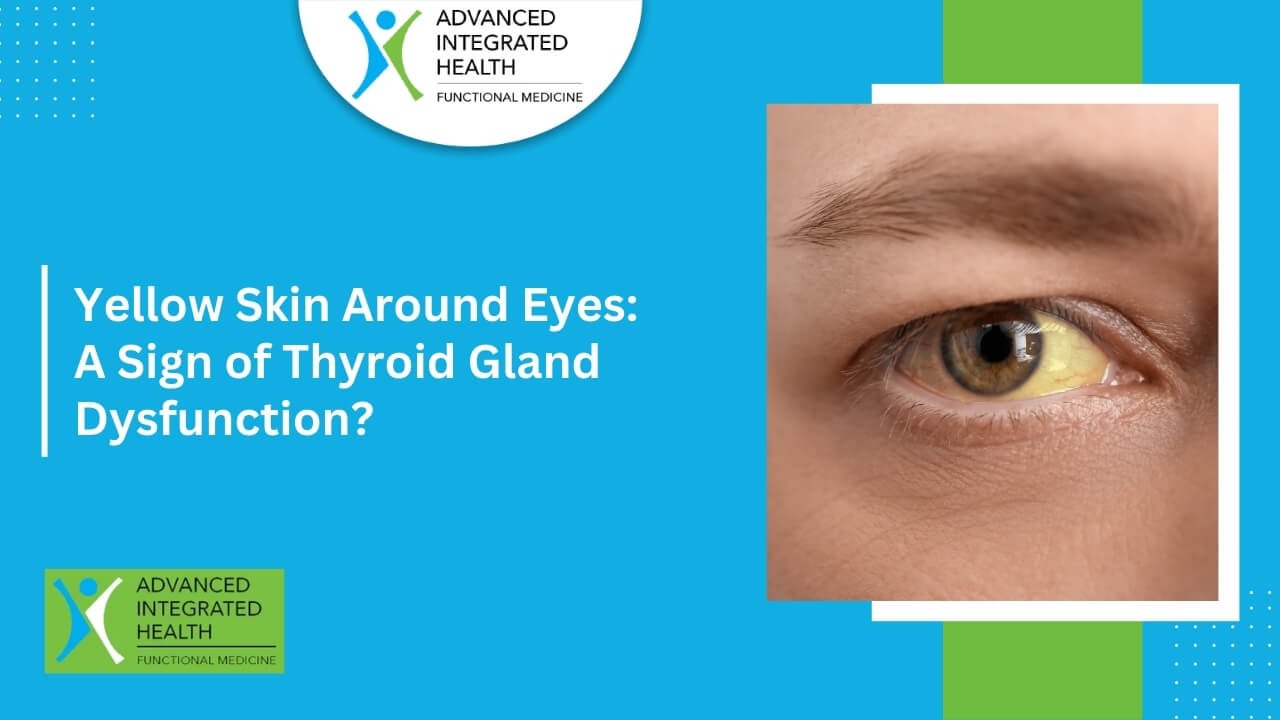 Yellow Skin Around Eyes: A Sign of Thyroid Gland Dysfunction?