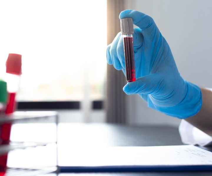 Blood samples for lab test